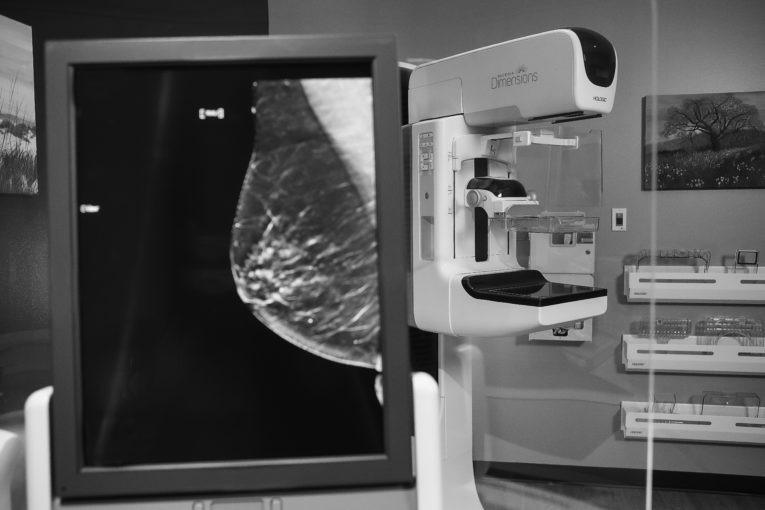 mammography machine