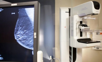 Mammography: Answers to common questions