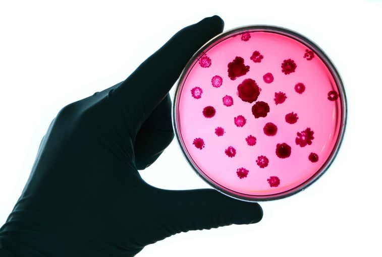 Gloved hand holds a red petri dish
