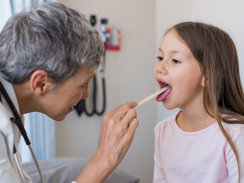 Tonsillectomies: Updated guidelines for surgery and care