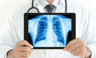 Respiratory therapists find home at Sanford Health