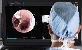 Sanford introduces better way to diagnose, treat lung cancer