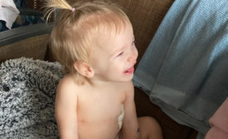Tiny incisions help tiny lung patient recover faster