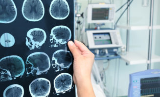 Change in behavior leads to brain tumor discovery