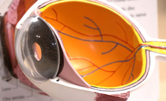 Cataract patients have options at Sanford Bemidji Eye Center