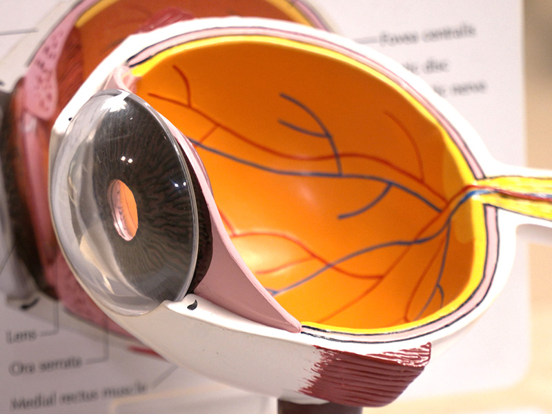 Cataract patients have options at Sanford Bemidji Eye Center