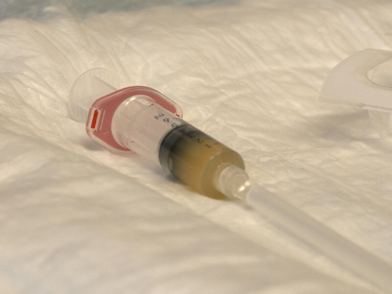 Closeup of a syringe filled with light brown liquid, sitting on an absorbent pad.