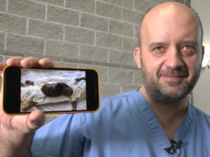 A Sanford Health surgeon in scrubs displays a dramatic photo on his phone: a pair of conjoined infant twins, attached at the tops of their heads, lying on a blanket.