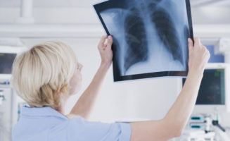 Lung scans reveal ‘cancers we get the opportunity to cure’