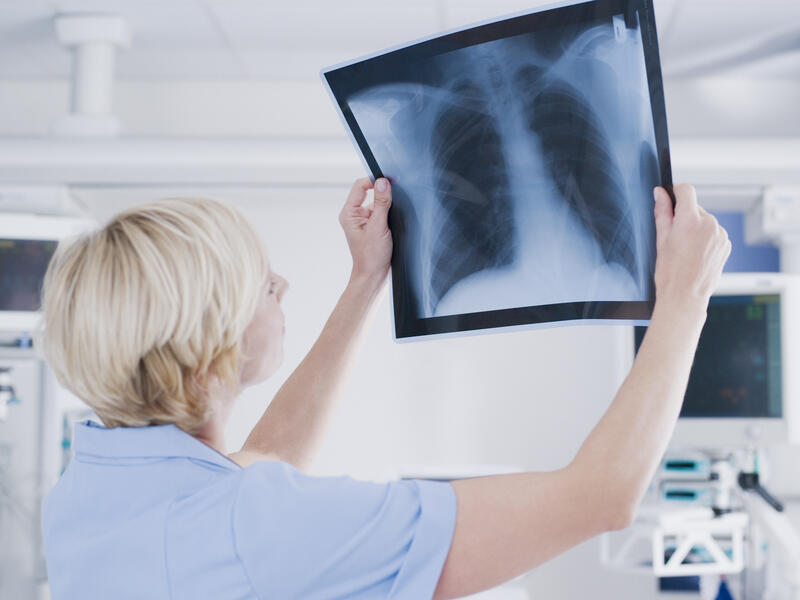 Lung scan reveals ‘cancers with treatment opportunities’