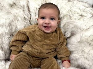 Smiling baby boy on a fuzzy blanket has a small surgical scar above his lip.