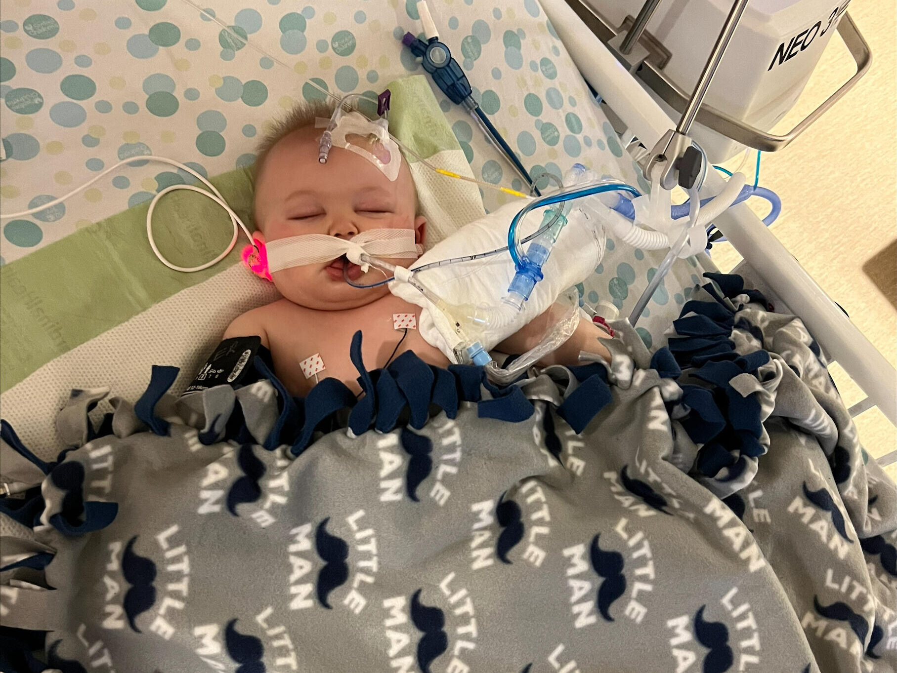 Baby boy sleeps in a hospital bed, hooked up to monitors and tubes.