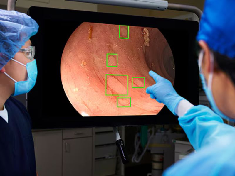 Sanford Fargo now offers AI-assisted colonoscopies