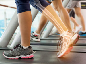 Digital composite of highlighted ankle bones of woman on treadmill.