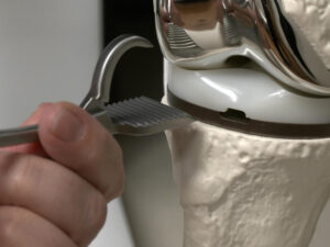 A hand holds a metal clamp up to a model of a human knee joint.