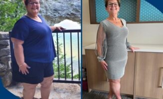 Weight loss surgery changes Bismarck woman’s life