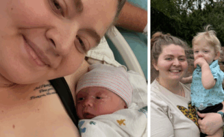 Things to consider when weighing a C-section