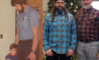 IORT, radiation therapy treatment for breast cancer