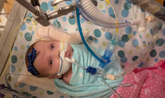 ECMO saves newborn with severe lung damage after RSV scare