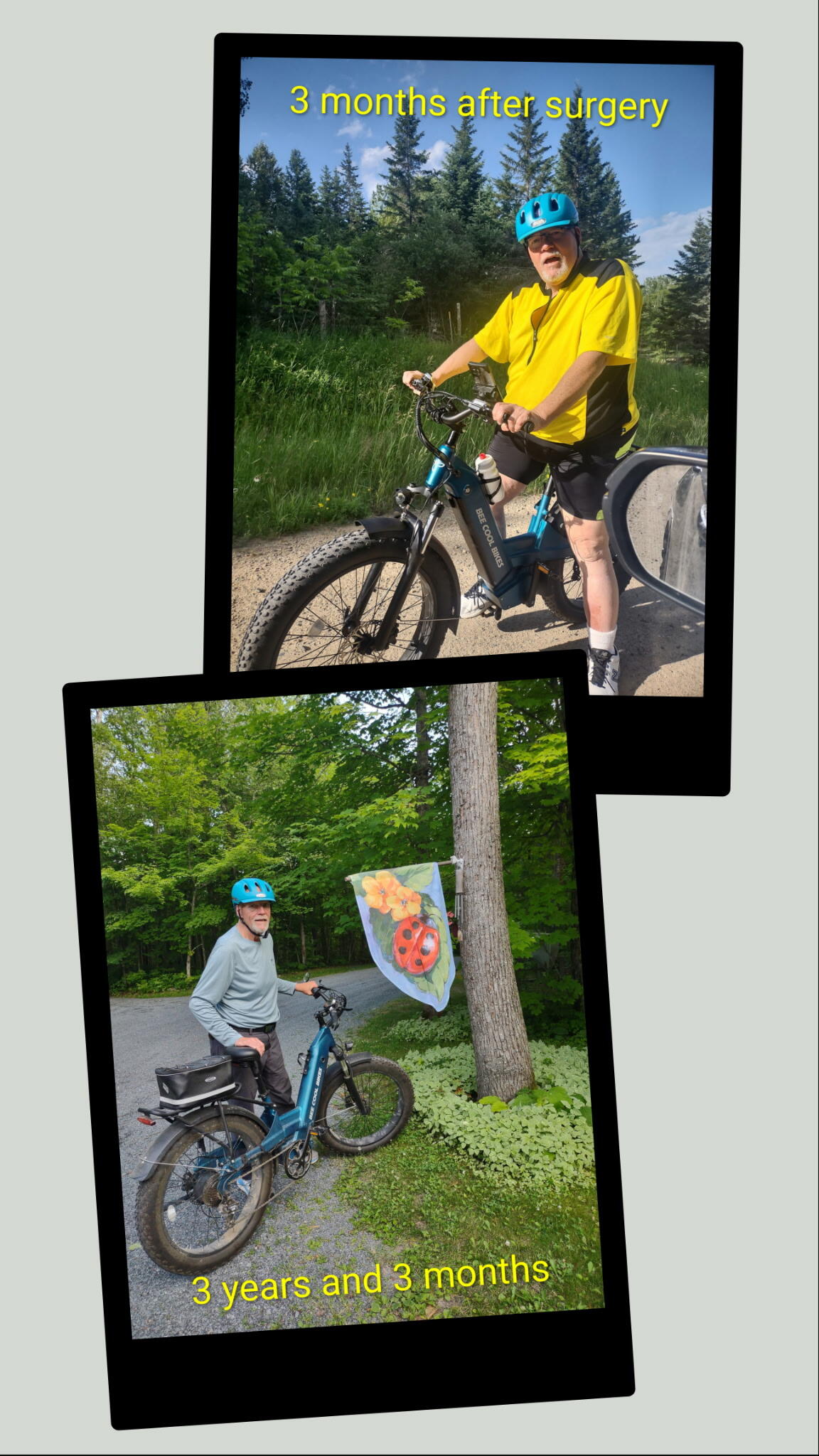 Two-photo collage of the same man on a bike, labeled "3 months after surgery" and "3 years and 3 months."
