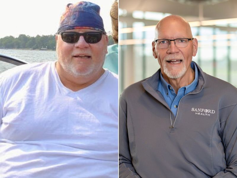 Minnesota man excited for the future after bariatric surgery